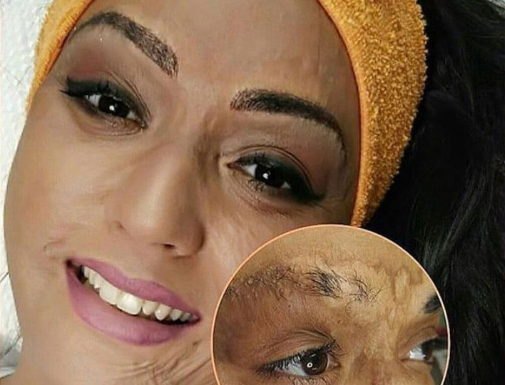 Projeto Dia da Fênix