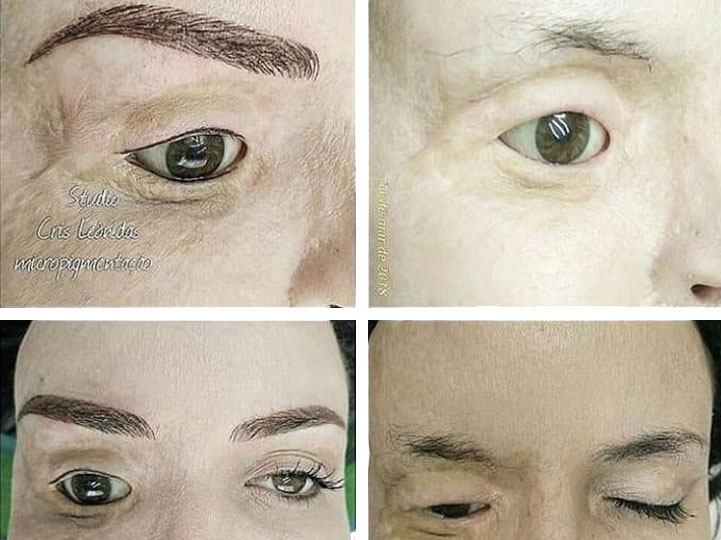 Projeto Dia da Fênix