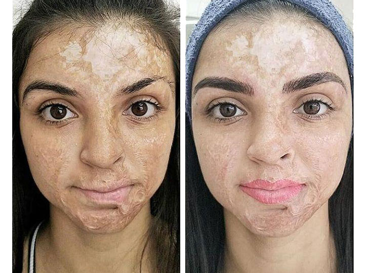 Projeto Dia da Fênix